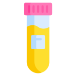 analisi-urine
